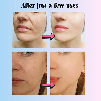 Orange Enzyme Gel